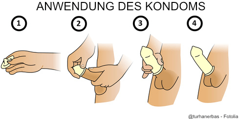 Anwendung Kondom